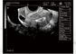 Varredor portátil do ultrassom da máquina portátil do ultrassom do bebê para a pediatria