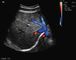 Varredor portátil do ultrassom da gravidez com os transdutores Transvaginal convexos abdominais