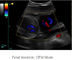Varredor portátil do ultrassom do equipamento da varredura do ultrassom com frequência 2. 0MHz~10. 0MHz da ponta de prova