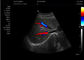 Equipamento portátil do ultrassom do varredor 4d do ultrassom da máquina médica do ultrassom