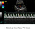 Colora o varredor portátil do ultrassom do sistema do ultrassom de Doppler com o monitor do diodo emissor de luz de 12,1 polegadas e os 2 portos da ponta de prova