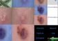 Detector Dermatoscope video da pele e do escalpe com relatório de Analysisi do pigmento do óleo da umidade flexível
