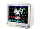 Equipamento de monitoração paciente portátil do veterinário dos animais da máquina do monitor paciente do animal de estimação do monitor paciente com acessórios animais