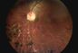 3,5&quot; equipamento diagnóstico da oftalmologia para o diabetes da glaucoma