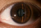 3,5&quot; equipamento diagnóstico da oftalmologia para o diabetes da glaucoma