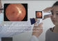 Telemedicina em um ângulo de visão da câmera do fundo de Digitas da oftalmologia do software opcional de um Wifi de 45 graus para o relatório