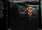 Da cor portátil Handheld do varredor do ultrassom de Ipad aplicação vascular abdominal da ginecologia da pediatria de Doppler