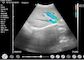 Do ultrassom à mão diagnóstico portátil de Doppler do ultrassom de Doppler da casa aplicação obstétrico da pediatria da ginecologia