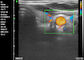 Do ultrassom à mão diagnóstico portátil de Doppler do ultrassom de Doppler da casa aplicação obstétrico da pediatria da ginecologia