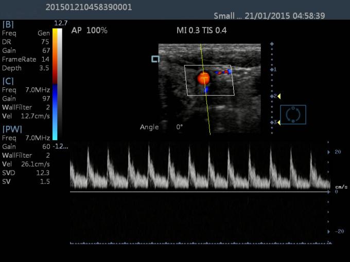 15 dispositivo diagnóstico portátil do ultrassom da máquina de Dopple da cor do ultrassom do LCD 2D do toque da polegada