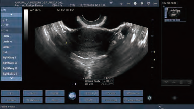 Dispositivos diagnósticos ultrassônicos portáteis da cor sem fio Transvaginal da ponta de prova do ultrassom da ponta de prova do ultrassom