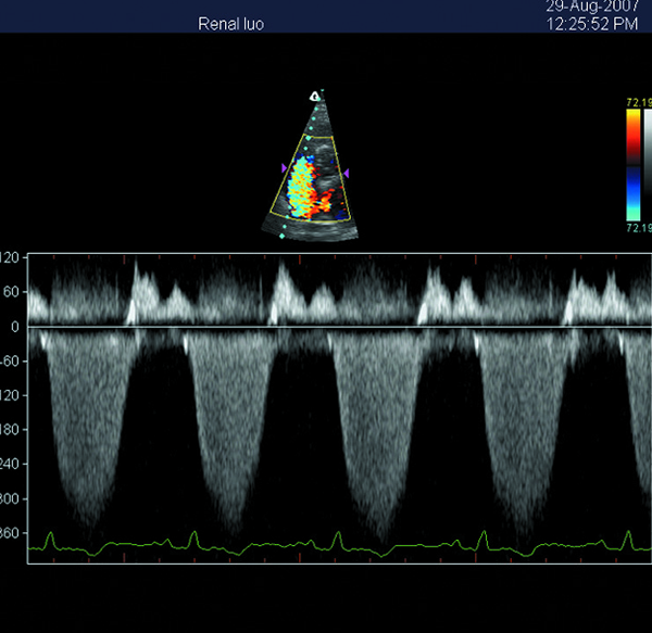 Varredor portátil do ultrassom de Doppler da cor da máquina do ultrassom 3D com a tela do diodo emissor de luz de 15 polegadas