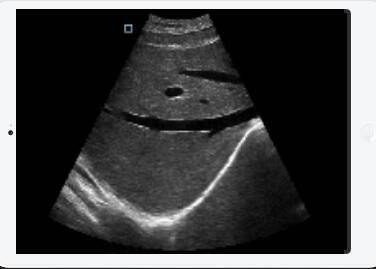 Ponta de prova cardíaca linear convexa da ponta de prova sem fio Transvaginal do ultrassom da ponta de prova do ultrassom destacável