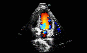 Varredor médico do ultrassom de Doppler da cor da máquina da varredura do ultrassom com transdutor cardíaco