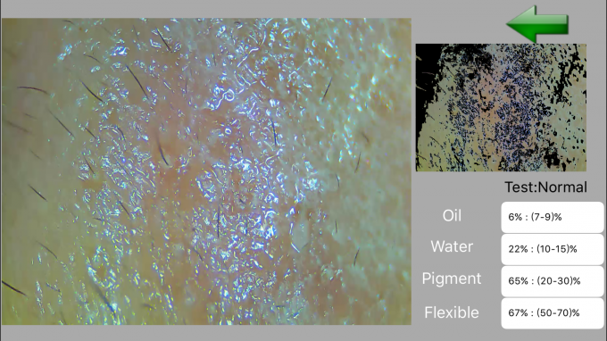 Dispositivo da análise da pele e do escalpe do analisador da pele de Digitas da luz UV mini com alta resolução