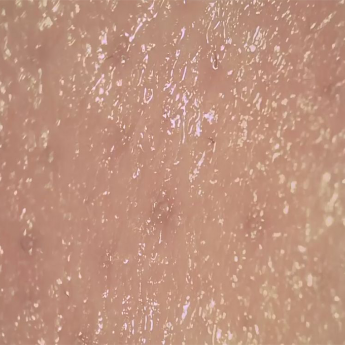 Analisador sem fio da pele de Digitas do detector da umidade da pele para observar a superfície dos poros de Derm da pele