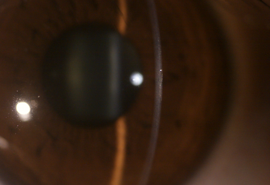 Do olho de superfície oftálmico disponível da câmera do olho da câmera do fundo de 3 Digitas do equipamento da lente lente anterior substituível