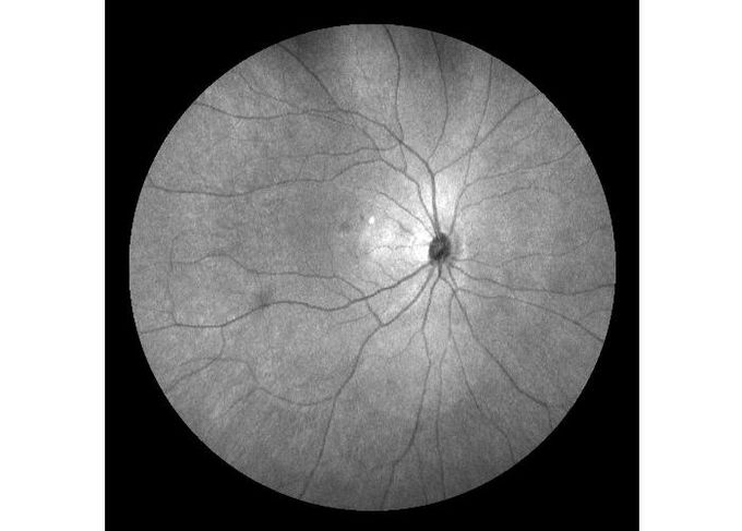 equipamento oftálmico Ultra-largo de Angiograph Digital da retina da exploração do laser do campo com zumbido ótico 100°/60°/30°