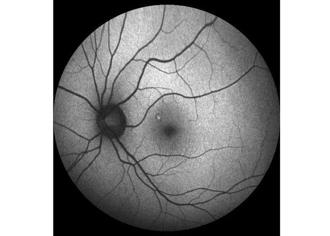 equipamento oftálmico Ultra-largo de Angiograph Digital da retina da exploração do laser do campo com zumbido ótico 100°/60°/30°