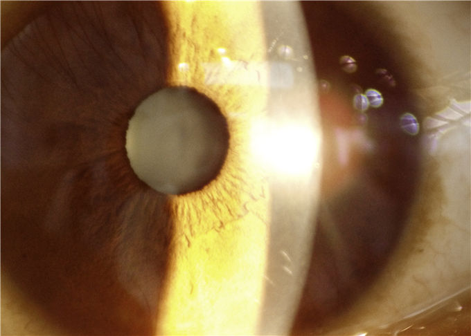 Lâmpada cortada portátil do dispositivo da oftalmologia da aplicação da telemedicina com largura cortada 0-12mm continuamente ajustáveis