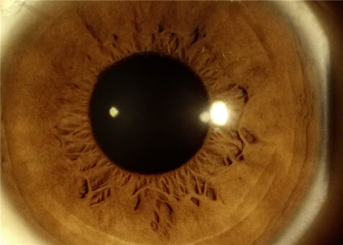 Equipamento cortado à mão da oftalmologia da lâmpada de Digitas usado para a ampliação anterior 16MP Resolution da imagem latente 10X do segmento
