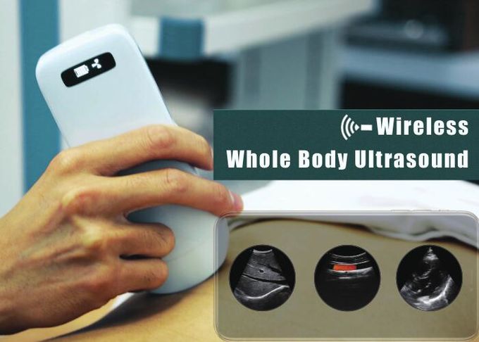 do ultrassom Handheld do bolso do varredor do ultrassom de 5G Wifi o carregador sem fio incorporado da bateria de lítio 4200mAh apoiou 1