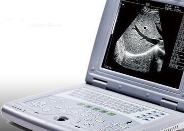 Máquina portátil do ultrassom para o peso 2.2kgs portátil do varredor do ultrassom da gravidez somente