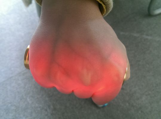 Alumínio dourado do localizador infravermelho vascular portátil da veia do inventor da veia de Venipuncture do projetor