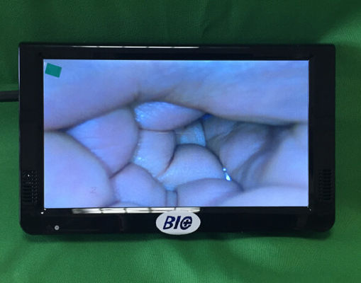 Colposcópio eletrônico digital portátil