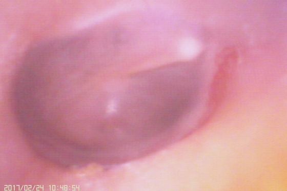 Otoscópio de Vídeo Digital 720X480