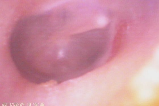 Otoscópio de Vídeo Digital 720X480