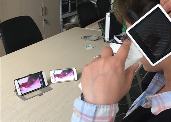 Otoscópio de Vídeo Digital 720X480