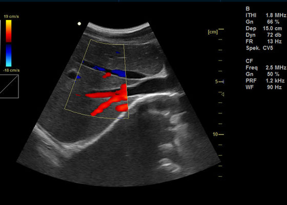 da máquina completa de Doppler da cor de 15 Digitas da polegada ultrassom portátil da imagem latente de Doppler com porta usb 2