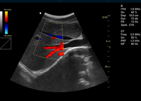 da máquina completa de Doppler da cor de 15 Digitas da polegada ultrassom portátil da imagem latente de Doppler com porta usb 2