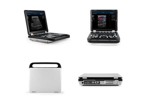 Varredor humano diagnóstico do ultrassom da máquina de Doppler da cor do diodo emissor de luz de 15 polegadas com conexão de 2 pontas de prova