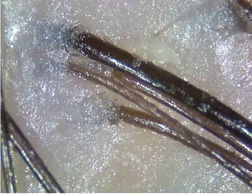 O dispositivo sem fio portátil do diagnóstico da telemedicina do analisador da pele de Digitas com polariza a luz