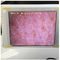 Sensor branco da umidade da pele do verificador da umidade da pele de Wifi com a foto que indica em Ipad