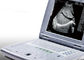Máquina portátil do ultrassom para o peso 2.2kgs portátil do varredor do ultrassom da gravidez somente