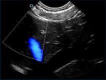 Ponta de prova Handheld de Doppler da cor do varredor do ultrassom do mini bolso variável com frequência de 2~11MHz
