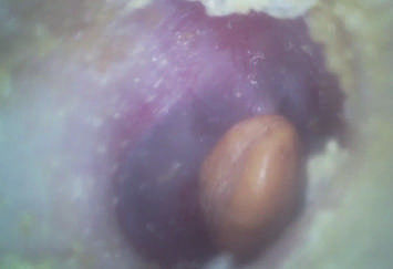 Otoscope video Handheld econômico de Digitas do espaço OTORRINOLARINGOLÓGICO portátil com o micro cartão flash do SD de 32G