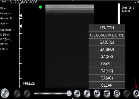 corpo convexo Handheld do varredor do ultrassom 5G: 3.5~5MHz, linear: 7.5~10MHz, cardíaco: 2.5~5MHz