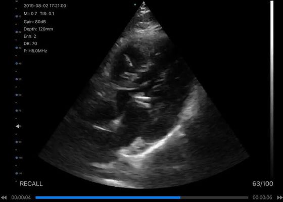 corpo convexo Handheld do varredor do ultrassom 5G: 3.5~5MHz, linear: 7.5~10MHz, cardíaco: 2.5~5MHz