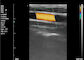 Ultrassom portátil do varredor do ultrassom da casa da máquina do ultrassom da cor para a gravidez 8 TGC 3.5~10 megahertz
