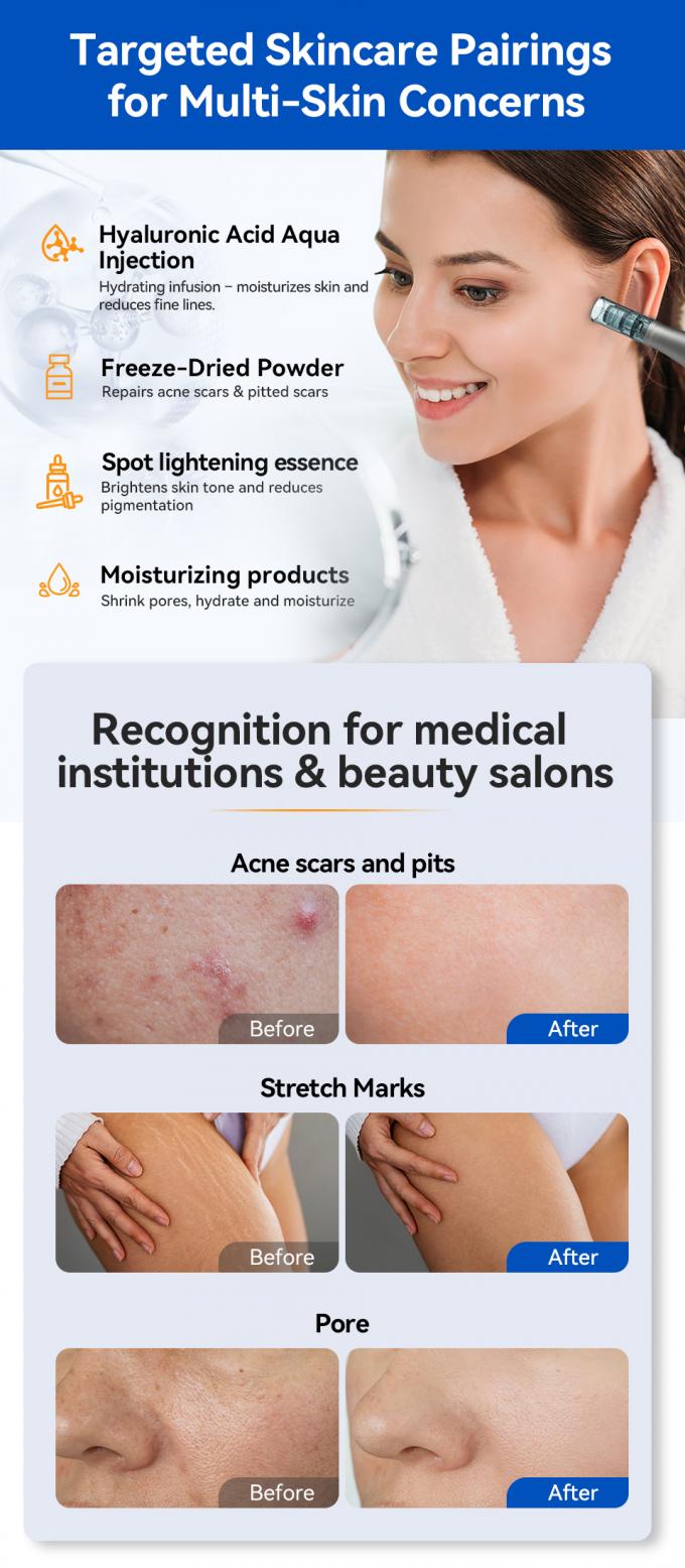 Nova Chegada Hydra Pen H5 Aplicador de Soro de Mesoterapia Beleza Cuidados com a Pele Bio Exosome Caneta de Microagulhamento D&eacute;rmico 6