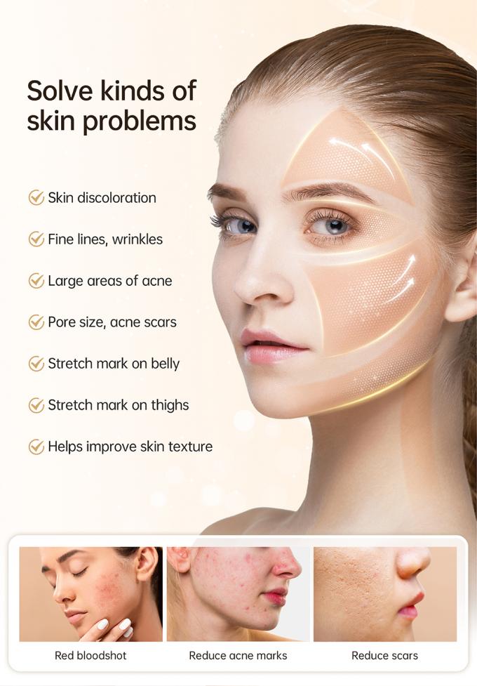 &Uacute;ltimo aplicador de soro autom&aacute;tico de 4 polos EMS Hydra Pen H5 Face Skin Derma Microneedling Pen Essence Regenera&ccedil;&atilde;o de col&aacute;geno 3