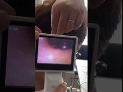 BIO-S1 otoscope operation