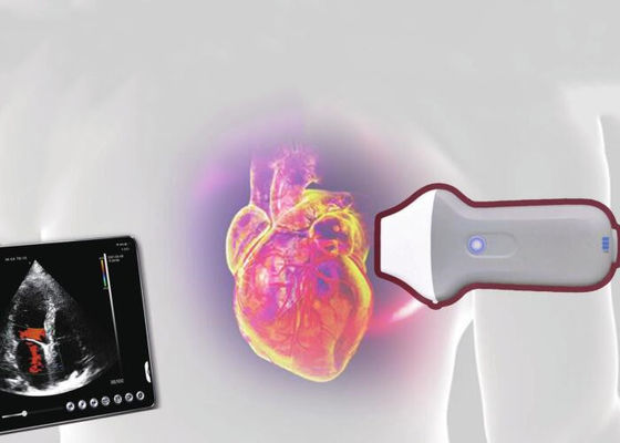 Elemento portátil do varredor 128 do ultrassom do rádio de PDI WiFi